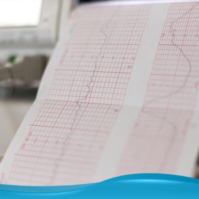 Image of a CTG chart for illustration purposes.